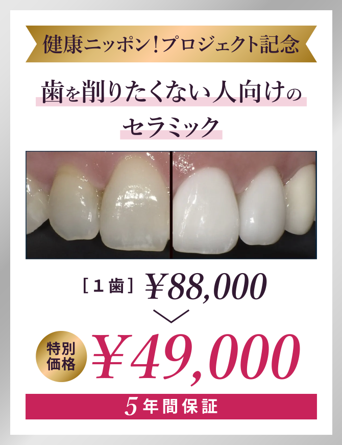 歯を削りたくない人向けのセラミック